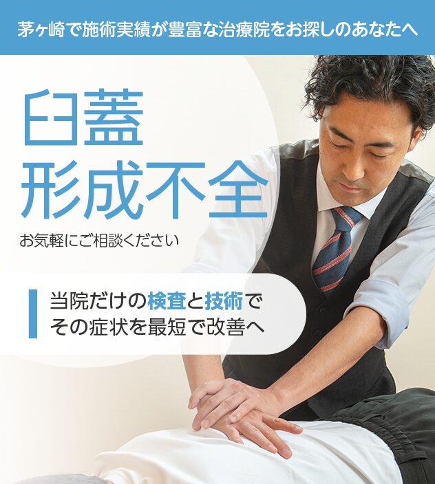 臼蓋形成不全もご相談ください